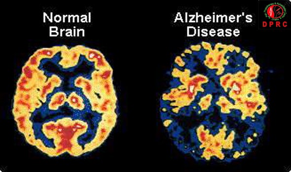 brain detoxify cells